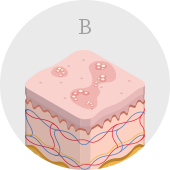 B